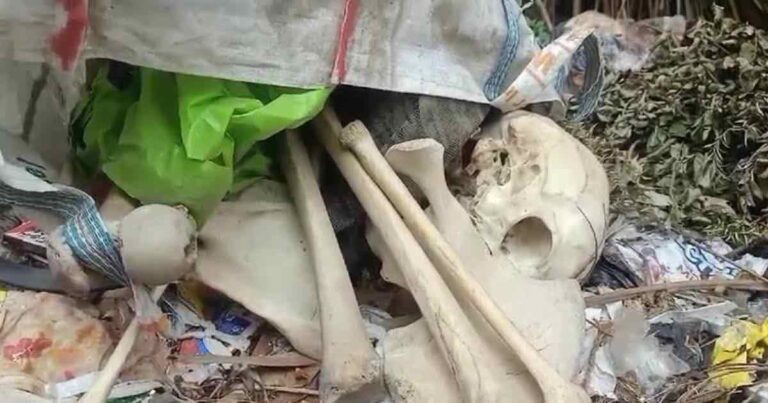 Skeleton Recovery in Baguiati